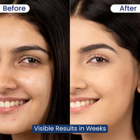 Aulgaria Face Serum